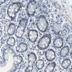Immunohistochemical staining of human duodenum shows moderate nuclear positivity in glandular cells.