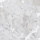 Immunohistochemical staining of human skeletal muscle shows no nuclear positivity in myocytes as expected.