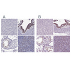 Immunohistochemical staining of human liver, placenta, testis and tonsil using Anti-ARID3A antibody HPA004793 (A) shows similar protein distribution across tissues to independent antibody HPA076330 (B).