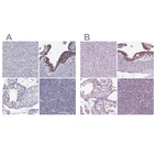 Immunohistochemical staining of human liver, placenta, testis and tonsil using Anti-ARID3A antibody HPA004793 (A) shows similar protein distribution across tissues to independent antibody HPA076330 (B).