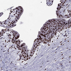 Immunohistochemical staining of human placenta shows strong nuclear positivity in trophoblastic cells.