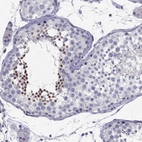Immunohistochemical staining of human testis shows moderate nuclear positivity in cells in seminiferous ducts.