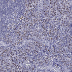 Immunohistochemical staining of human tonsil shows moderate nuclear positivity in non-germinal center cells.