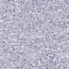 Immunohistochemical staining of human liver shows no positivity in hepatocytes as expected.