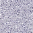 Immunohistochemical staining of human liver shows no positivity in hepatocytes as expected.