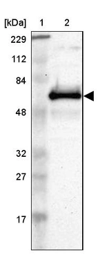 Lane 1: Marker [kDa] 229, 112, 84, 48, 32, 27, 17_br/_Lane 2: Human cell line RT-4