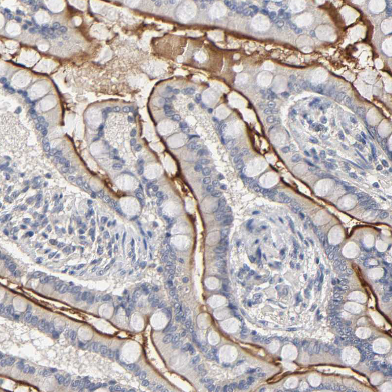 Anti-SLC10A2 Antibody