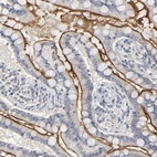 Anti-SLC10A2 Antibody