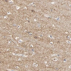 Immunohistochemical staining of human cerebral cortex shows moderate positivity in neuronal processes in neuropil.