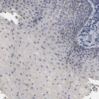 Immunohistochemical staining of human tonsil shows no positivity in squamous epithelial cells as expected.