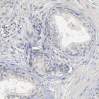Immunohistochemical staining of human prostate shows no positivity in glandular cells as expected.