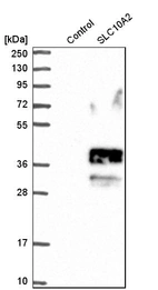 Western blot analysis in control (vector only transfected HEK293T lysate) and sLC10A2 over-expression lysate (Co-expressed with a C-terminal myc-DDK tag (~3.1 kDa) in mammalian HEK293T cells, LY424708).