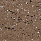 Immunohistochemical staining of human cerebral cortex shows strong cytoplasmic positivity in neurons.