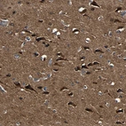 Immunohistochemical staining of human cerebral cortex shows strong cytoplasmic positivity in neurons.