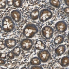 Immunohistochemical staining of human duodenum shows moderate cytoplasmic positivity in glandular cells.