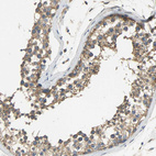 Immunohistochemical staining of human testis shows moderate cytoplasmic positivity in cells in seminiferous ducts.