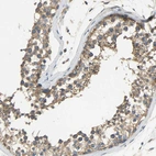 Immunohistochemical staining of human testis shows moderate cytoplasmic positivity in cells in seminiferous ducts.