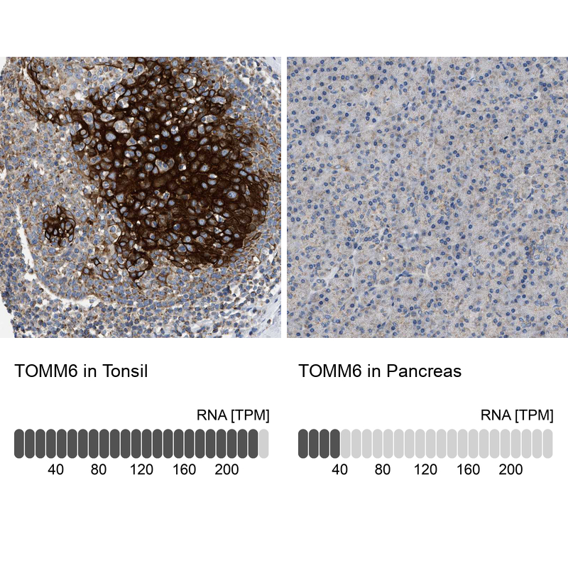Anti-TOMM6 Antibody
