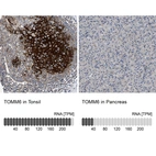 Anti-TOMM6 Antibody