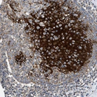 Immunohistochemical staining of human tonsil shows strong granular cytoplasmic positivity in squamous epithelial cells.