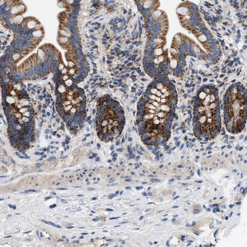 Rabbit Polyclonal Anti-TOMM6 Antibody - Buy for research - Highly ...