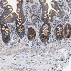 Immunohistochemical staining of human small intestine shows strong granular cytoplasmic positivity in glandular cells.