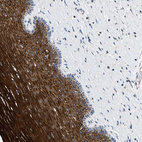 Immunohistochemical staining of human cervix shows strong granular cytoplasmic positivity in squamous epithelial cells.