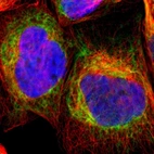 Immunofluorescent staining of human cell line A-431 shows localization to mitochondria.