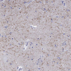 Anti-LAMP5 Antibody