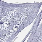 Immunohistochemical staining of human skin shows no positivity in squamous epithelial cells as expected.