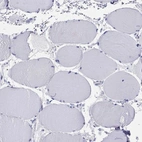 Immunohistochemical staining of human skeletal muscle shows no positivity in myocytes as expected.