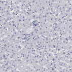 Immunohistochemical staining of human liver shows no positivity in hepatocytes as expected.