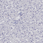 Anti-LAMP5 Antibody