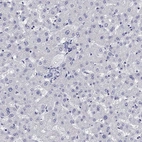 Immunohistochemical staining of human liver shows no positivity in hepatocytes as expected.