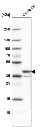 Western blot analysis in human cerebral cortex tissue.