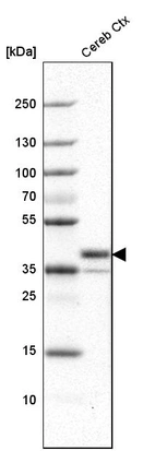 Western blot analysis in human cerebral cortex tissue.