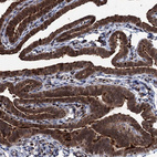 Anti-EYA4 Antibody