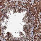 Immunohistochemical staining of human prostate shows moderate nuclear positivity in glandular cells.