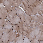 Anti-EYA4 Antibody