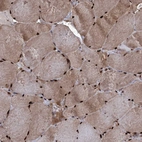 Immunohistochemical staining of human skeletal muscle shows strong nuclear positivity in myocytes.