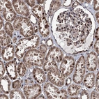 Immunohistochemical staining of human kidney shows strong nuclear positivity in cells in tubules.