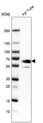 Western blot analysis in human fallopian tube tissue.