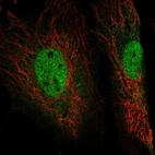 Immunofluorescent staining of human cell line HeLa shows localization to nucleoplasm.