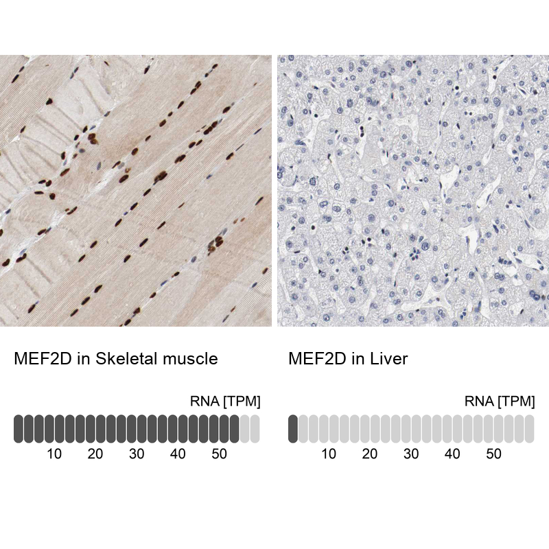 Anti-MEF2D Antibody