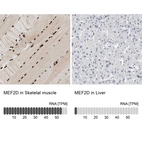 Anti-MEF2D Antibody