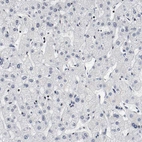 Immunohistochemical staining of human liver shows no positivity in hepatocytes as expected.
