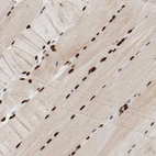 Immunohistochemical staining of human skeletal muscle shows strong nuclear positivity in myocytes.