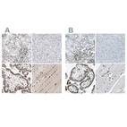 Immunohistochemical staining of human kidney, liver, placenta and skeletal muscle using Anti-MEF2D antibody HPA004807 (A) shows similar protein distribution across tissues to independent antibody HPA007114 (B).