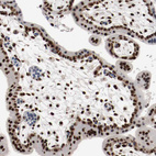 Immunohistochemical staining of human placenta shows strong nuclear positivity in trophoblastic cells.