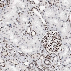 Immunohistochemical staining of human kidney shows strong nuclear positivity in cells in glomeruli.